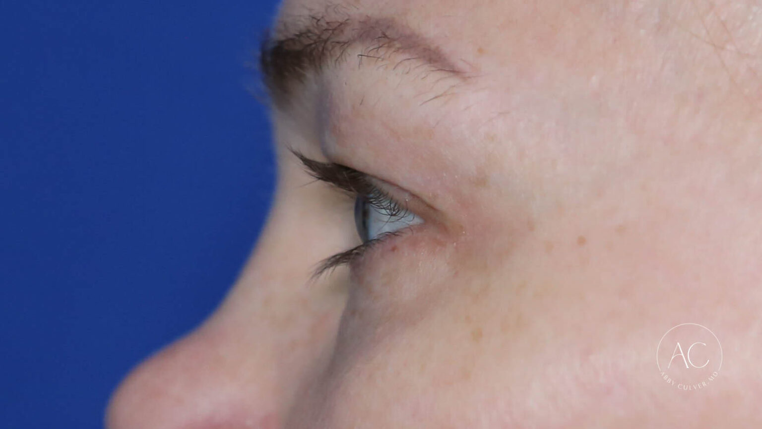 1C0CC0B1-ADD0-4DEB-A8CD-D41DFEA2BB20