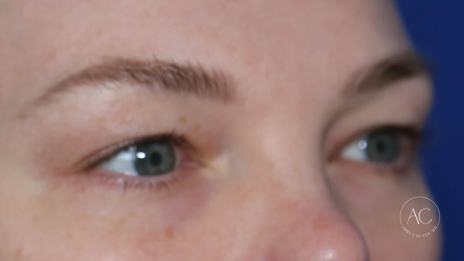 82D59F8A-C2DA-4B59-A4D3-9AB8207D9CC9